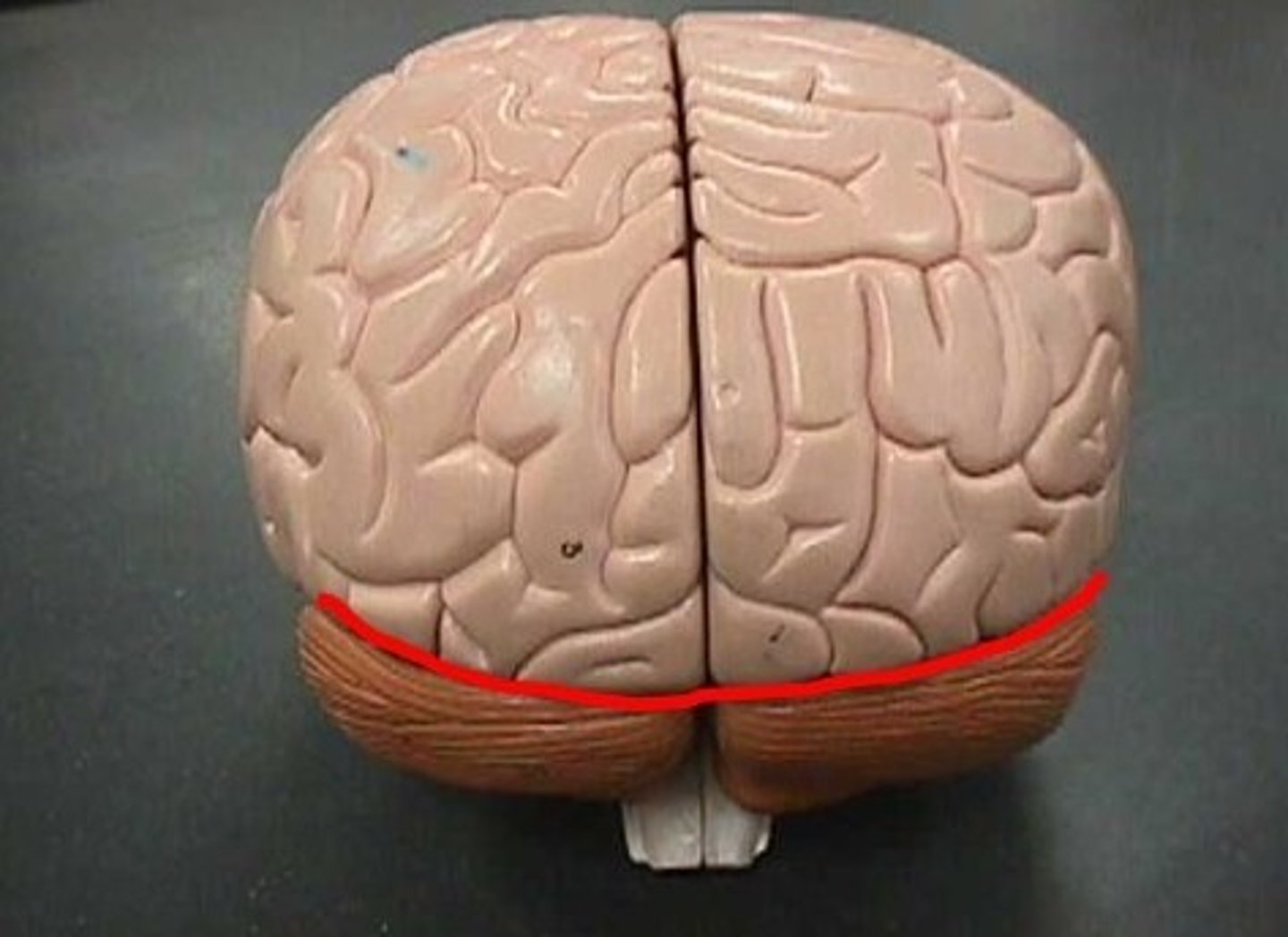 <p>Separates cerebrum/cerebellum</p>