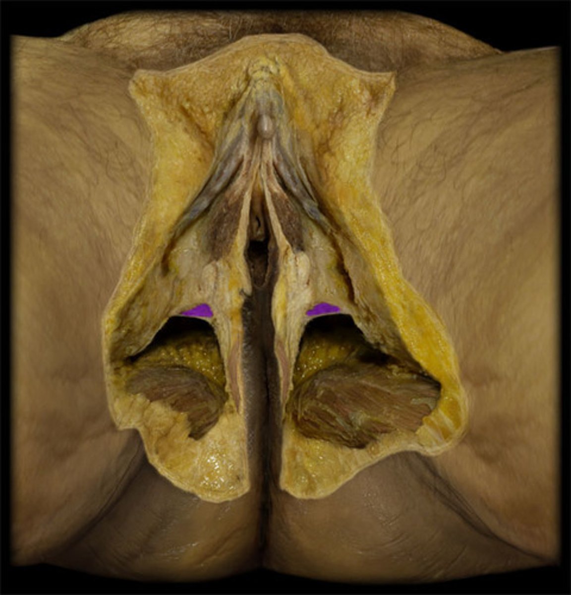 <p>stabilizes central tendon of perineum</p>