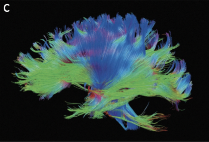 <p>Visualize axon fiber tracts</p>