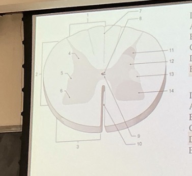 <p>Identify the structure labeled “I”. </p>