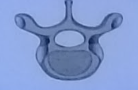 <ul><li><p>Located at upper and mid-back</p></li><li><p>12 vertebrae</p></li><li><p>Medium size </p></li><li><p>Larger, body, smaller foramen</p></li><li><p>Larger and pointed</p></li><li><p>Protects the heart and lungs, supports the ribs </p></li></ul><p></p>