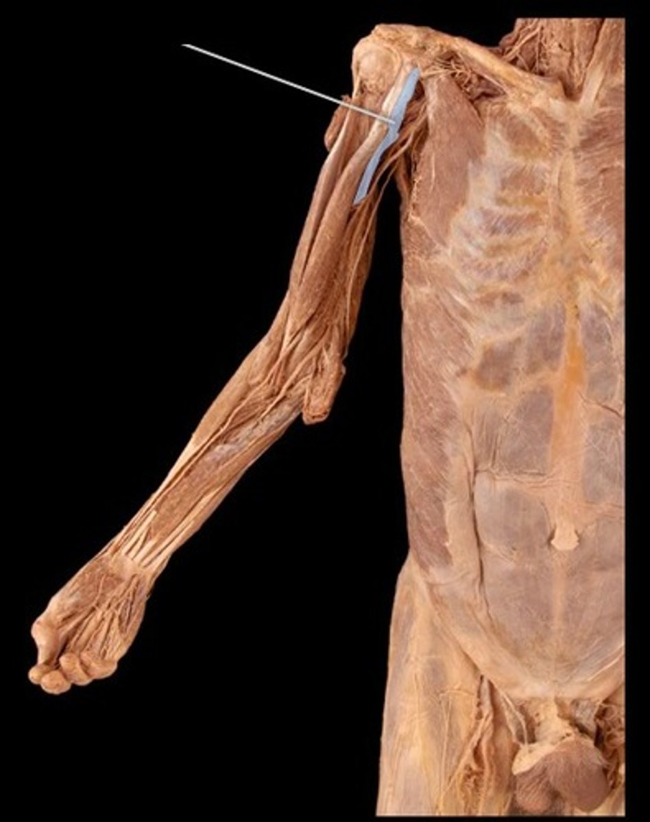 <p>What muscle is this?</p>