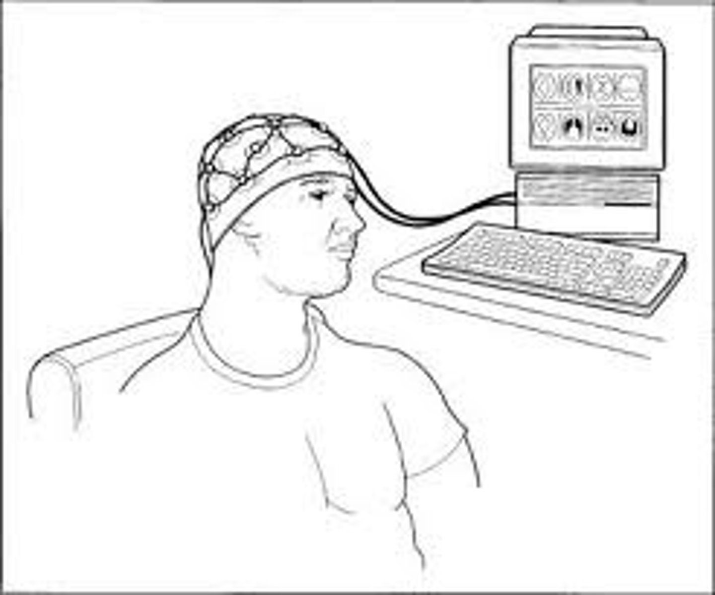 <p>Amplified recording of brain's electrical waves. Helpful in diagnosing seizures.</p>