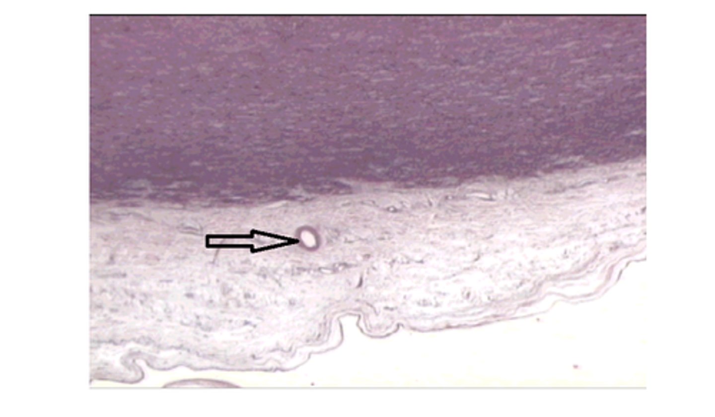 <p>The structure at the arrow could be found in which of the following blood vessels?</p><p>It could be found in any of the mentioned blood vessels</p>