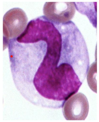 <p>What kind of Agranulocyte is indicated in this image?</p>
