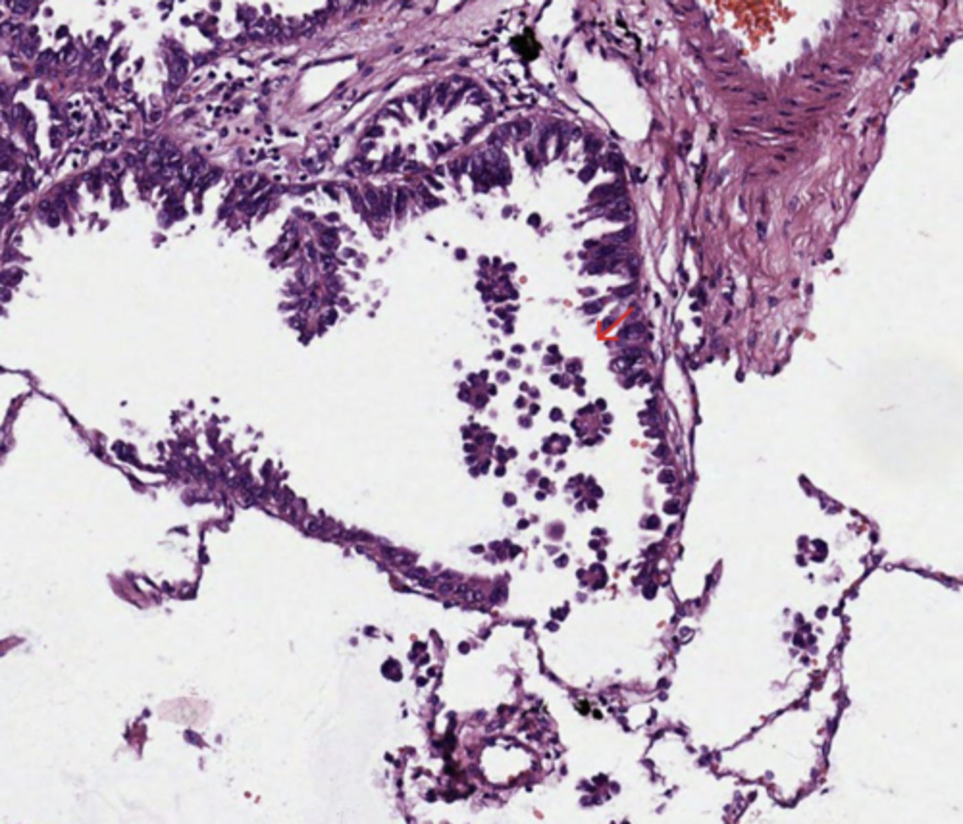 <p>Lung</p>