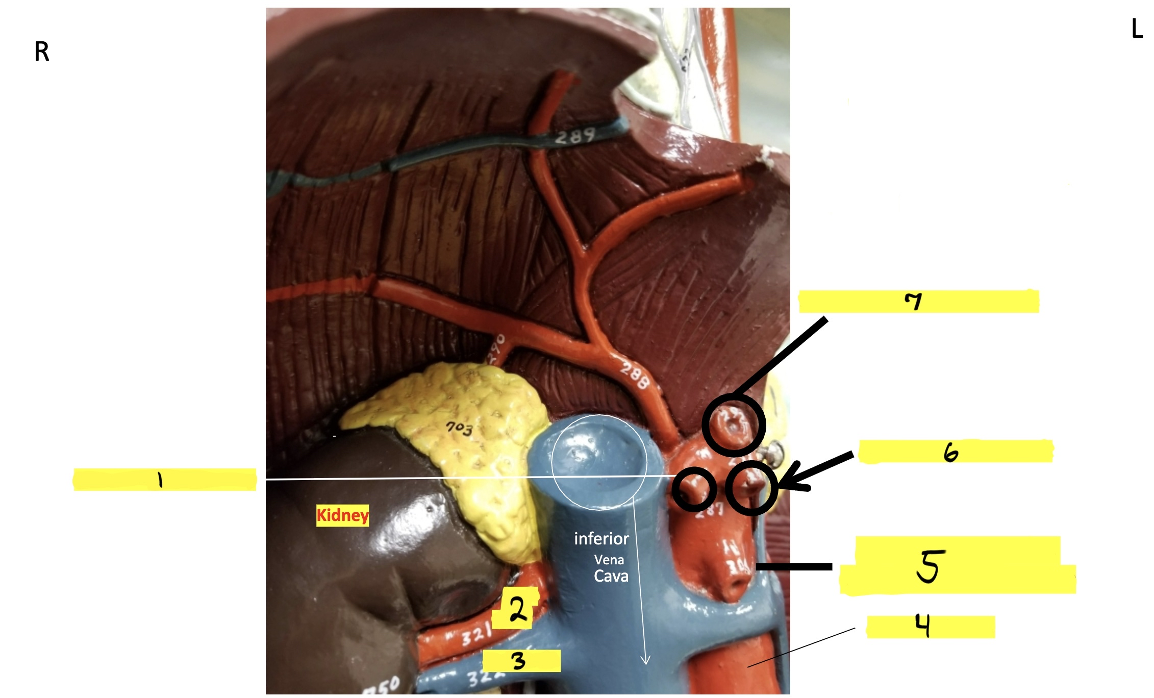 <p>what is #5 in this image?</p>