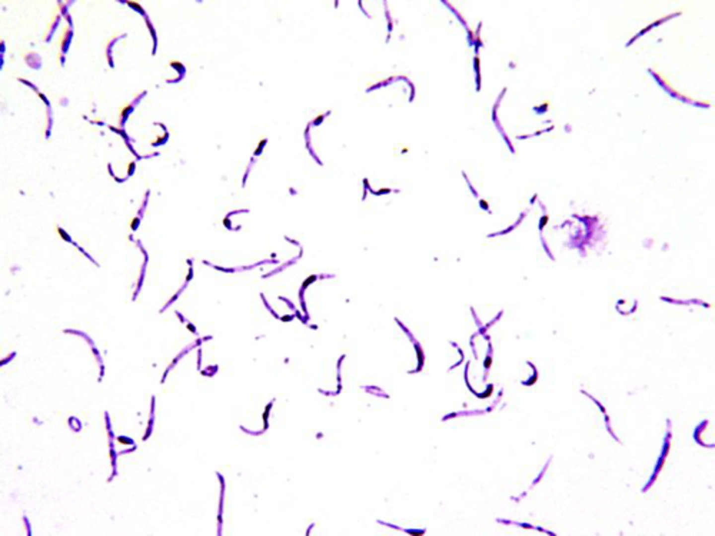 <p>Name the stage and species</p>
