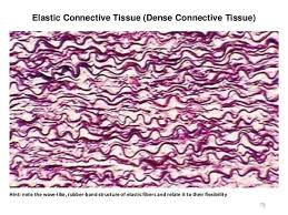 <p><span style="color: blue"><strong>Elastic</strong></span><strong> Dense Connective Tissue </strong></p>