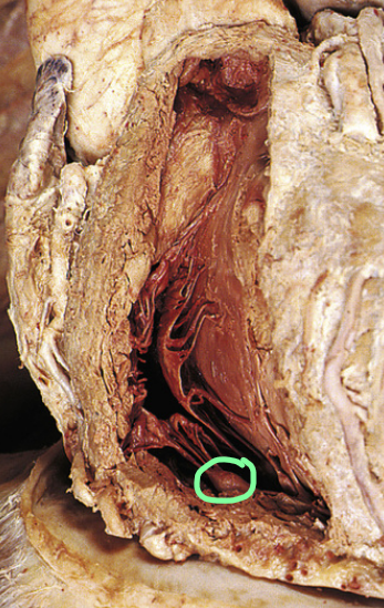 <p>What is circled?</p>