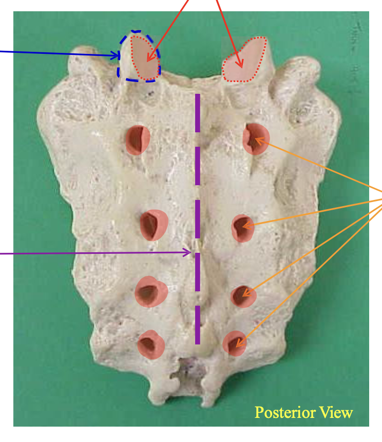 <p>Name the highlighted structure</p>