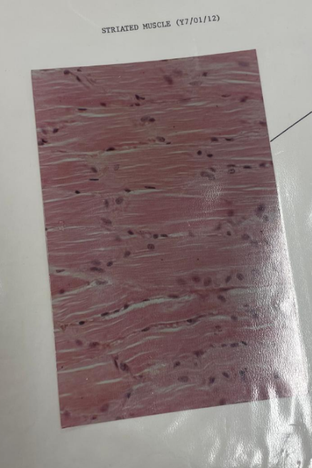 <p>what is this? what is the line pointing to?</p>