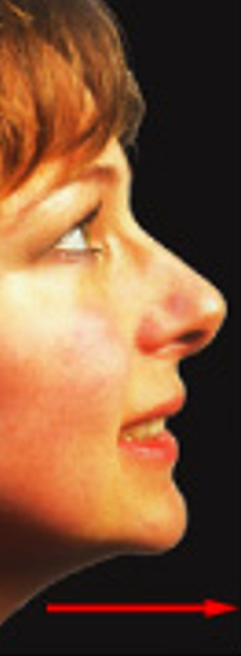 <p>Which special movement is:</p><ul><li><p>Moves anteriorly</p></li><li><p>In the horizontal plane (pushing forward)</p></li></ul><p></p>