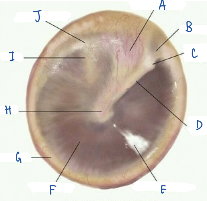 <p>What part of the tympanic membrane is labeled I?</p>