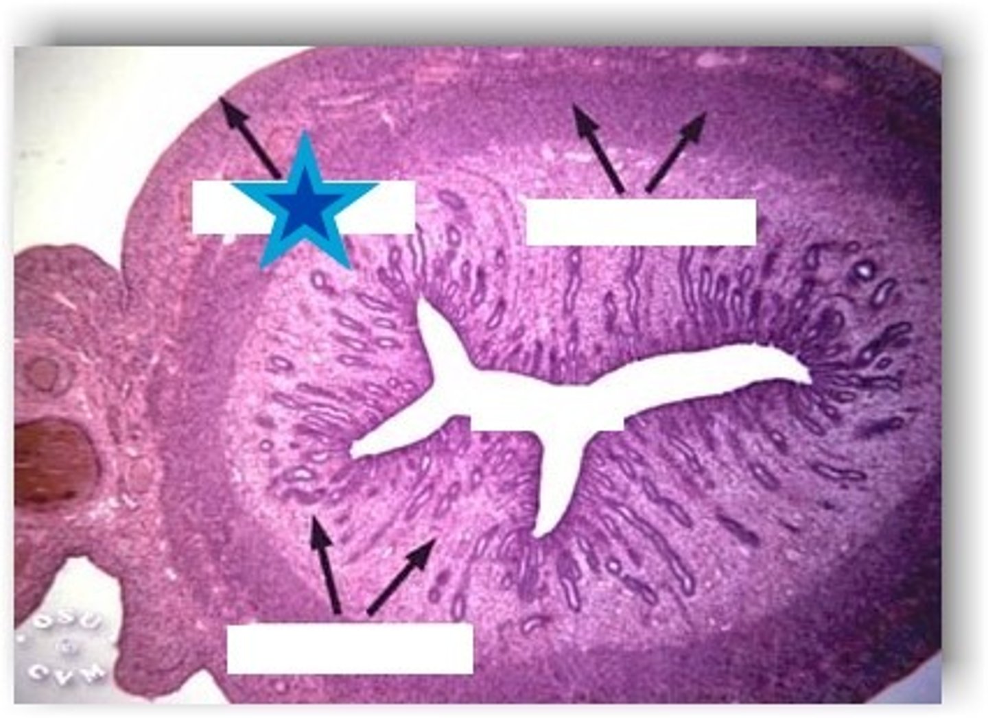 <p>The outermost layer</p>
