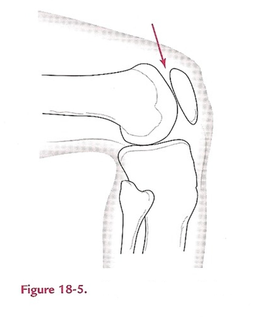 <p>Name the structure.</p>