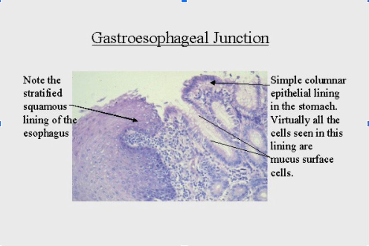 <p>- esophagus: stratified squamous epithelium</p><p>- stomach: simple columnar epithelium</p>