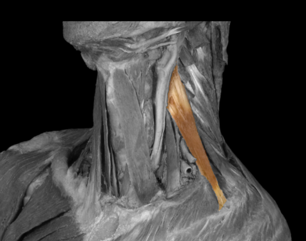 <p>What muscle is this? </p>