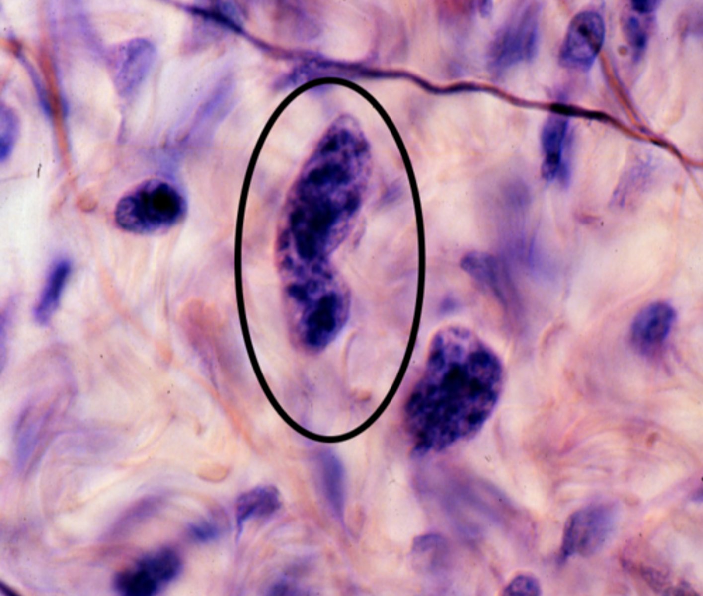 <p>This specimen is from a trypan-blue treated rat, what cell-type iscircled?</p>
