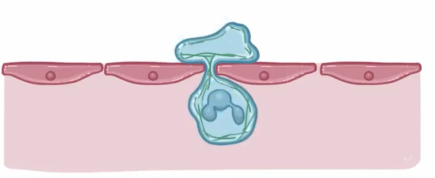 <p>neutrophil squeezes through to the other side of the endothelial layer. </p>