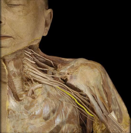 name this plexus and nerve