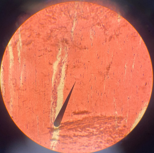 <p>example: tendons<br>function: connects muscle to bone</p>
