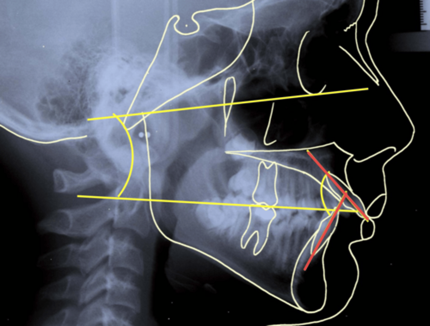 <p>ID the measurement being taken by the red lines:</p>