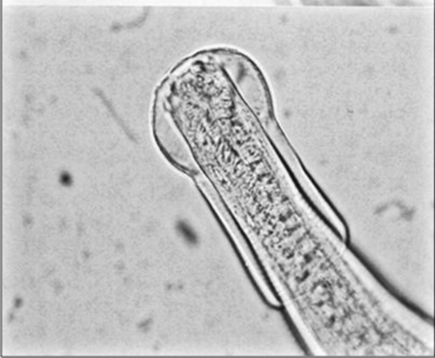 <p>What is this parasite? What characteristic/s did you use to identify it?</p>