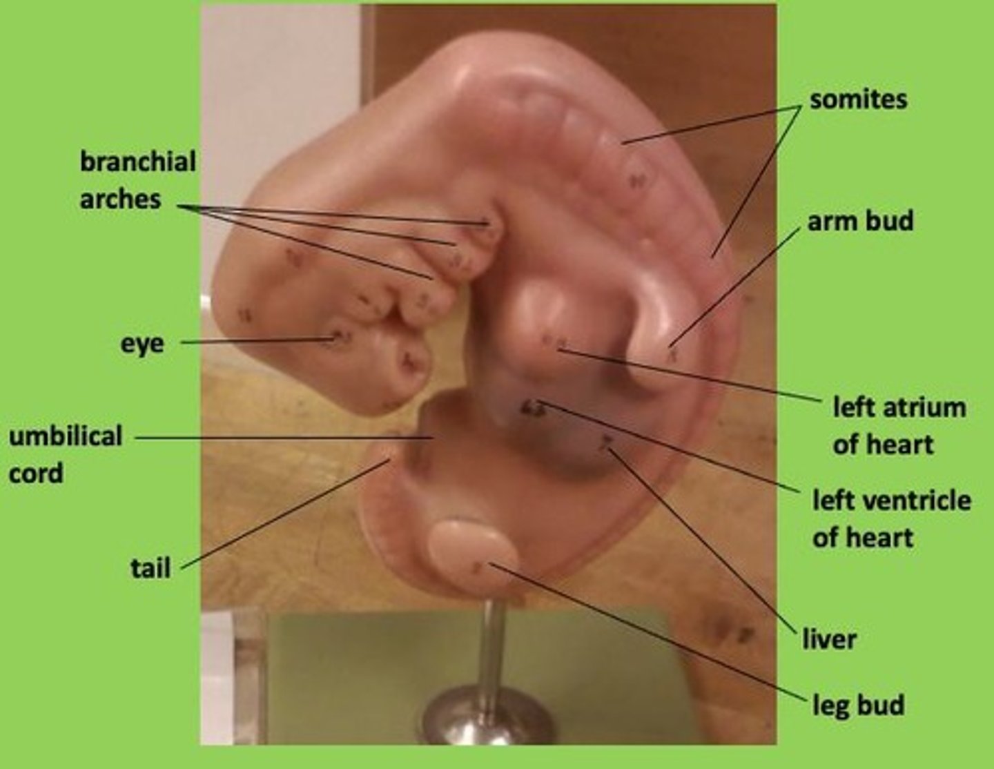 <p>Series arranged along dorsal margin of the embryo; give rise to vertebrae and associated muscles</p>
