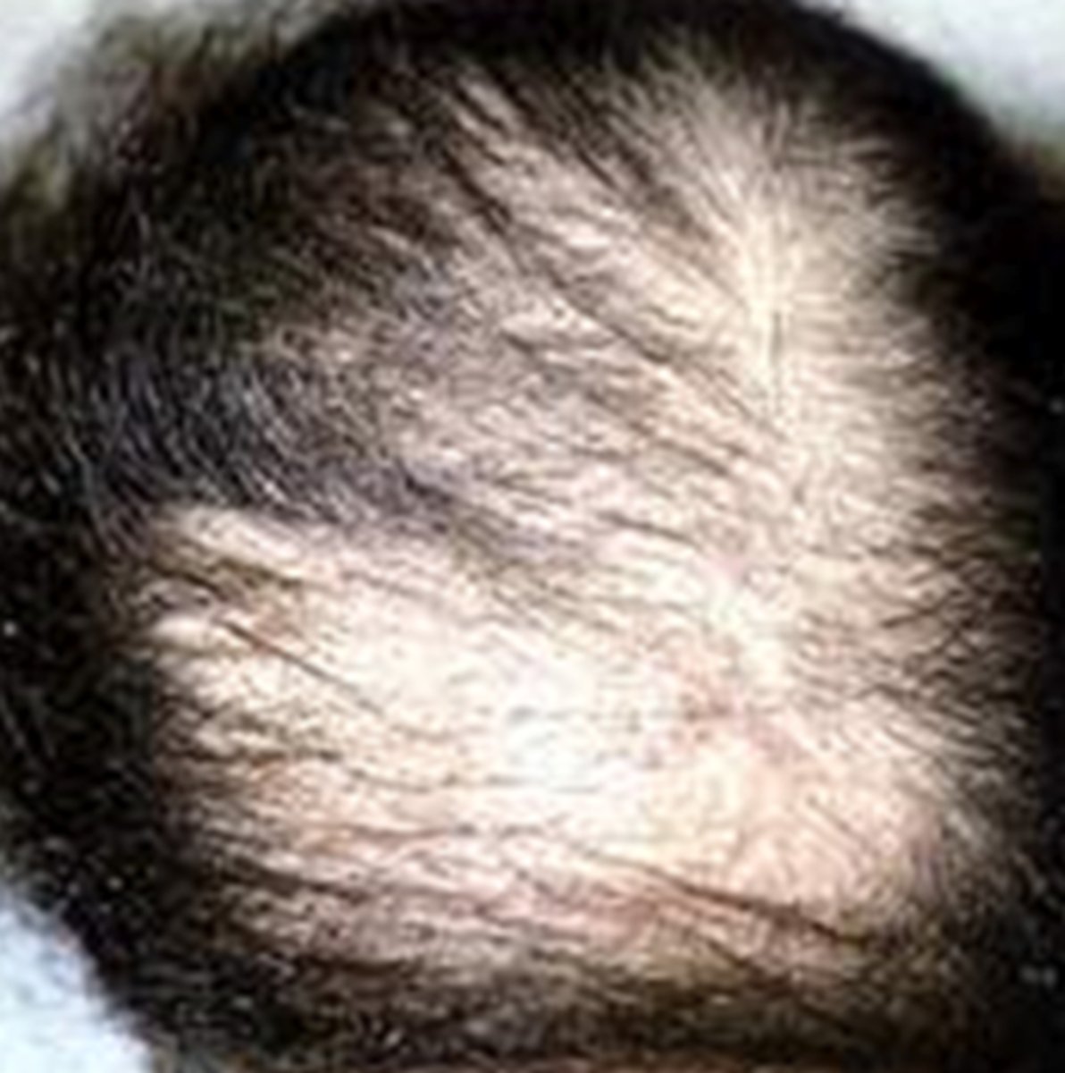 <p>What is the diagnosis?</p>