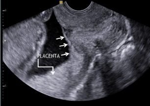 <p>what is this image showing?</p>