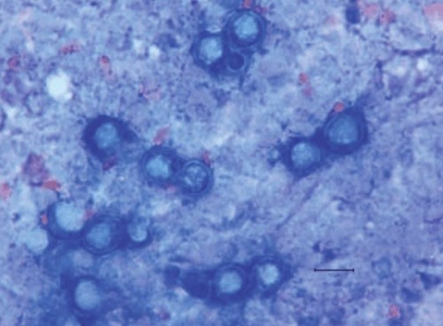 <p>• Broad based budding yeast (BBB)</p><p>often with double contours</p><p>• Mold form is not very distinct</p>