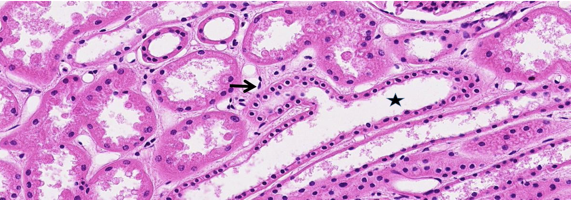 <p>This is a section of the kidney. A.  ID the epithelium at the star. B. ID the epithelium at the arrow.</p>