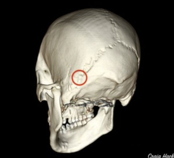 <p>Separates the parietal, temporal, and occipital (In the back)</p>