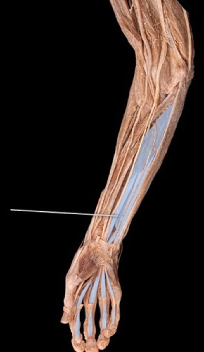 <p>What muscle is this?</p>