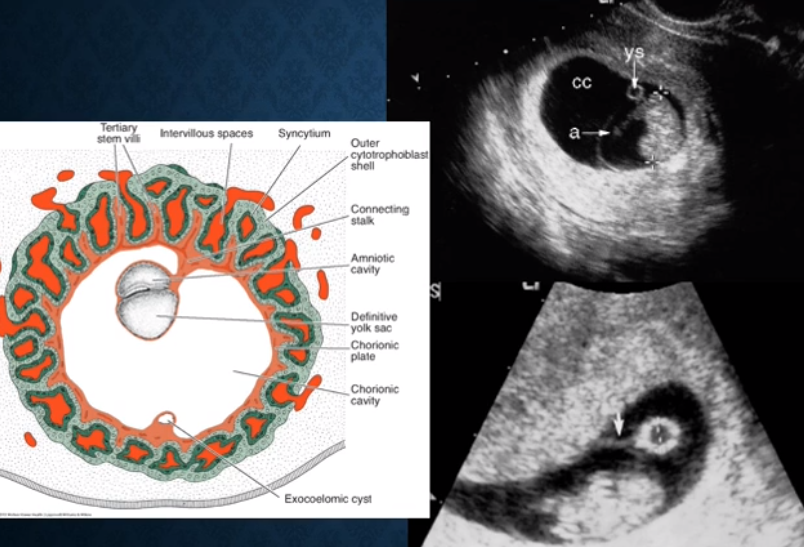 <p>identify: embryo, secondary yolk sac, and amnion in this photo!</p>