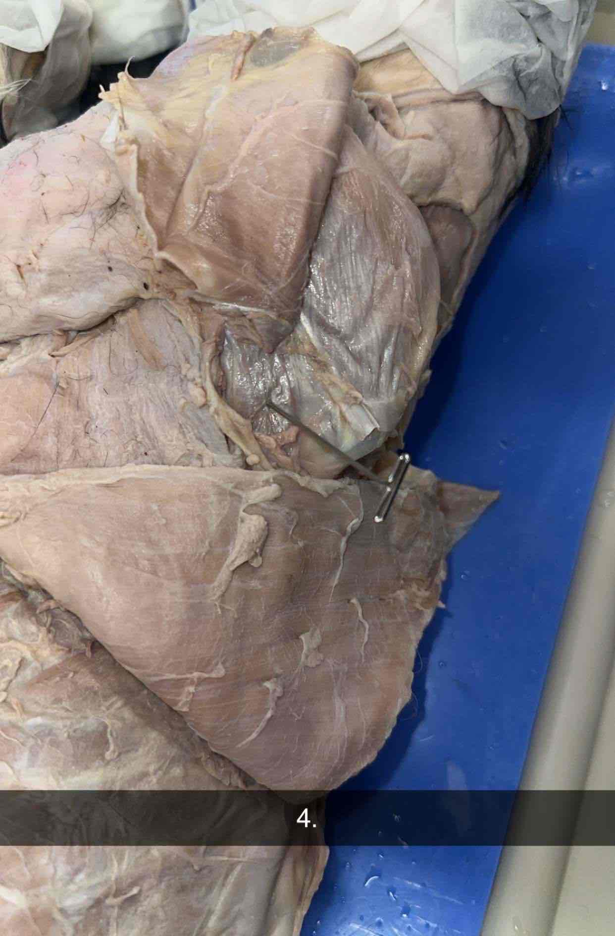 <p>What muscle is this?</p>