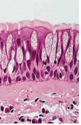 type of epithelial tissue, function, and location?