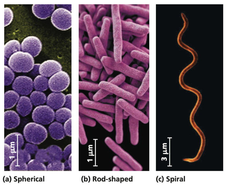 1. Cocci (spherical)
2. Bacilli (rod-shaped)
3. Spiral