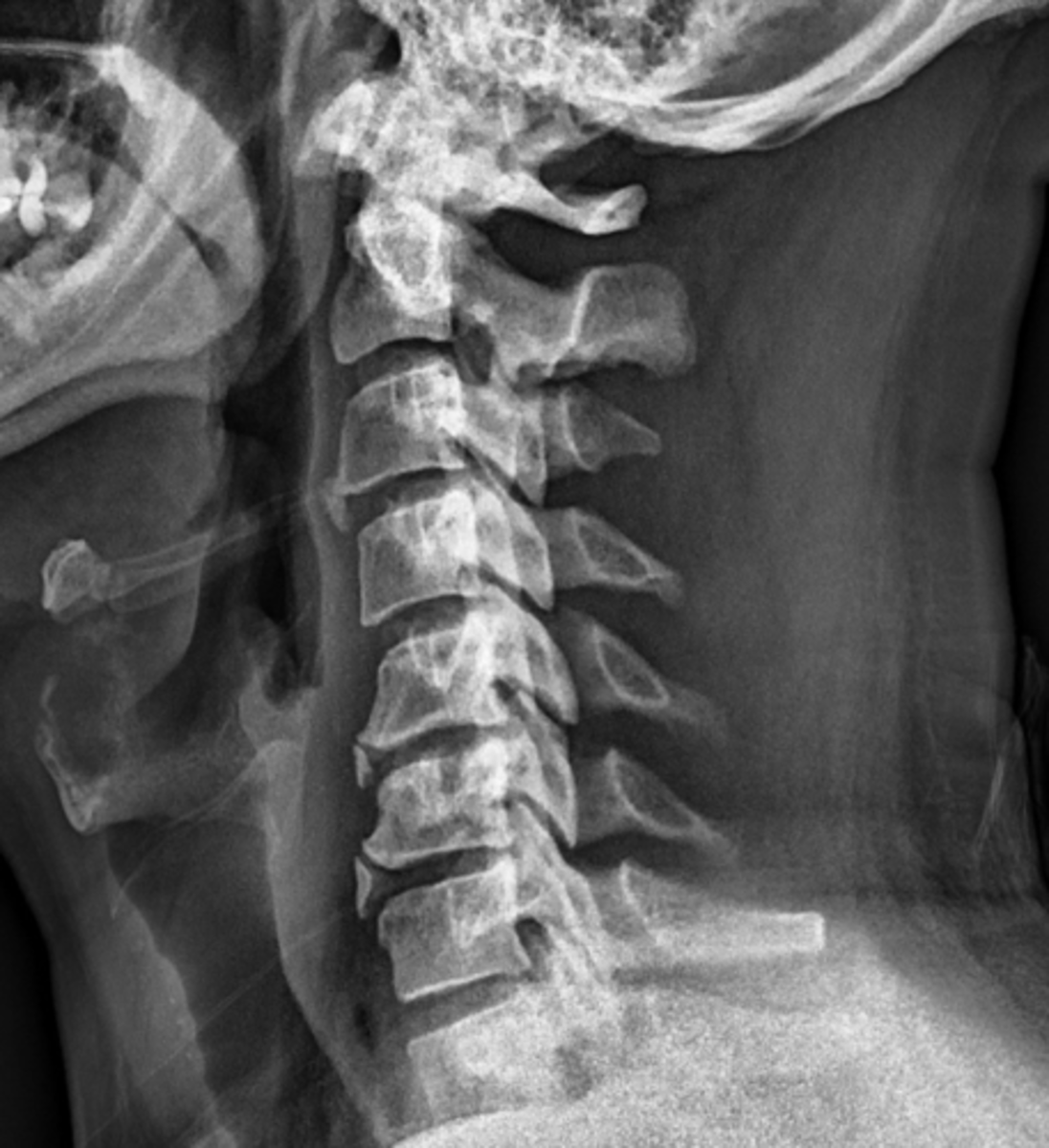 <p>State diagnosis</p>