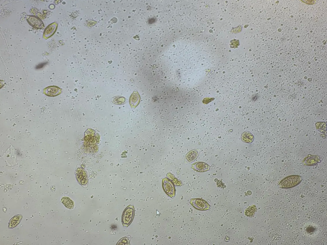 <p>in fecal sample</p>