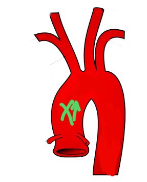 <p>First part of aorta; receives blood directly from left ventricle.</p>