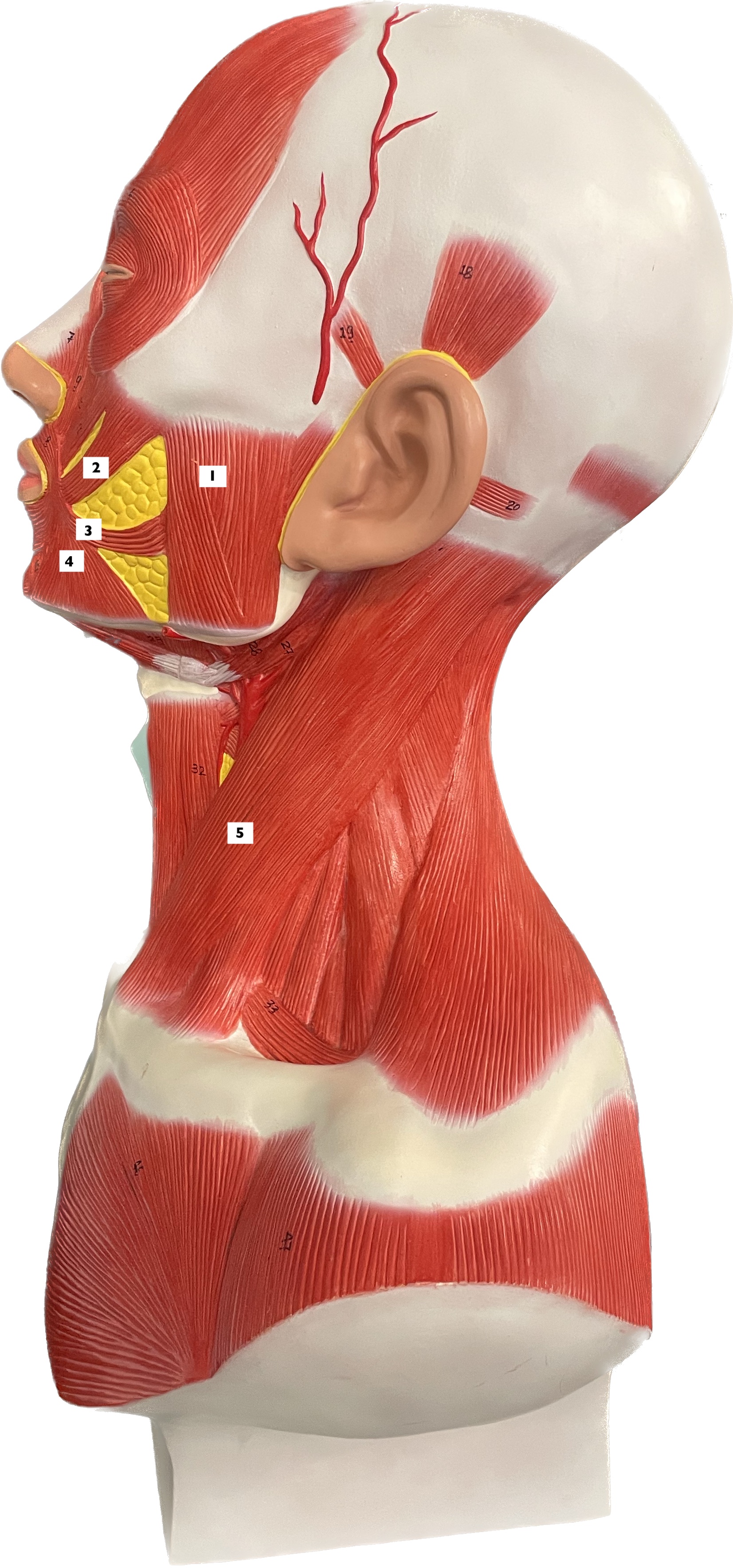 * masseter - elevates mandible
* origin: zygomatic arch and zygomatic bone
* insertion: angle and ramus of mandible