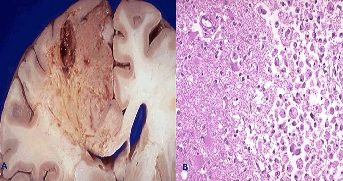 <p>A- identify</p><p>B- Describe A&amp;B</p>