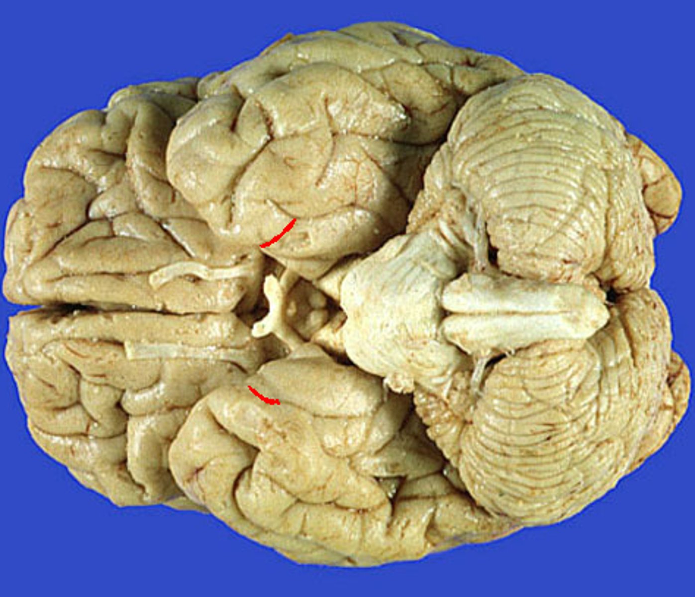 <p>by the temporal bone</p>