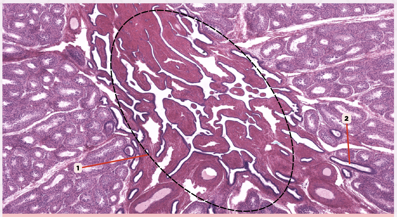 <p>What epithelium lines #1?</p>