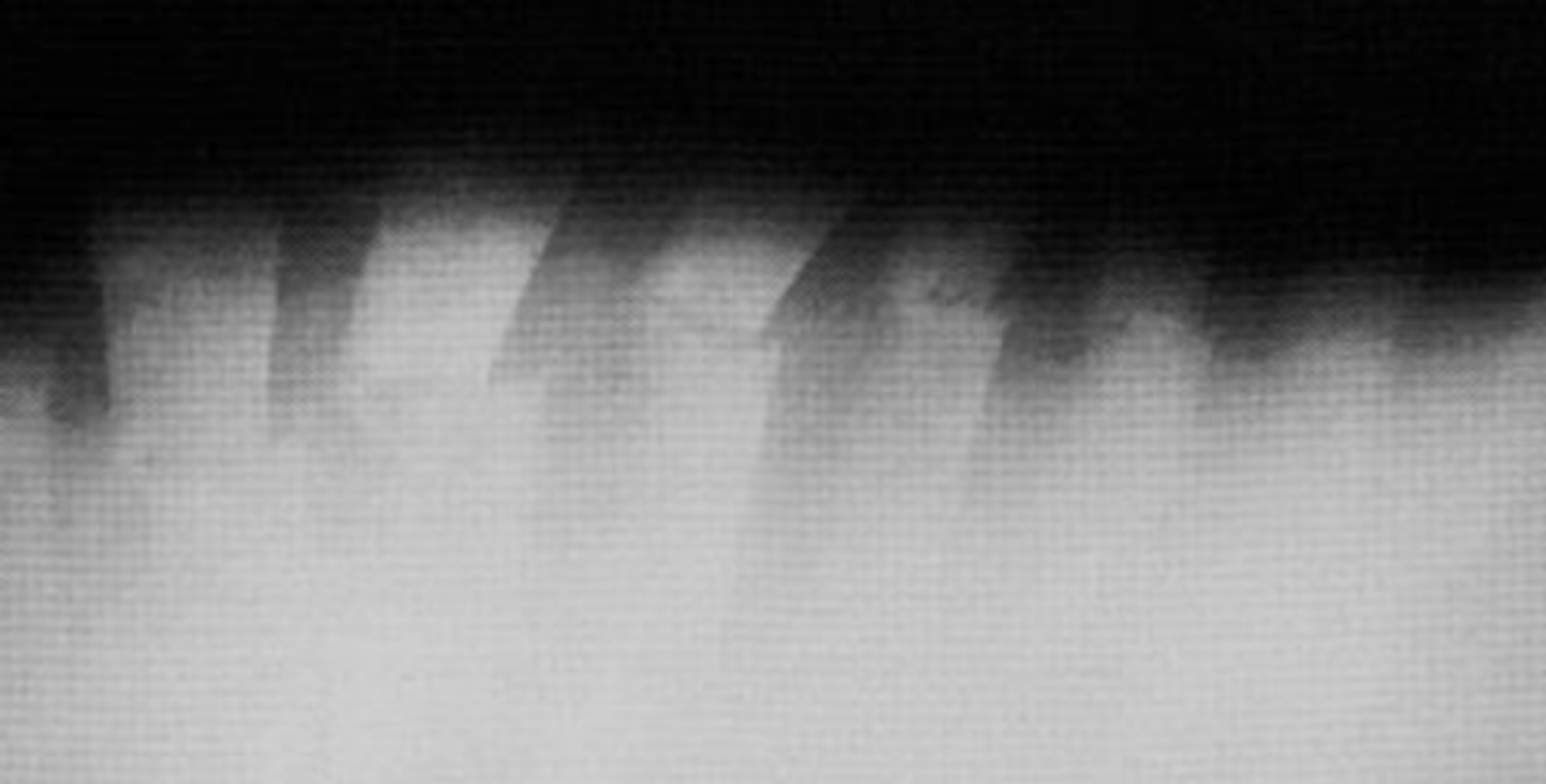 <p>What kind of fracture is this?</p>