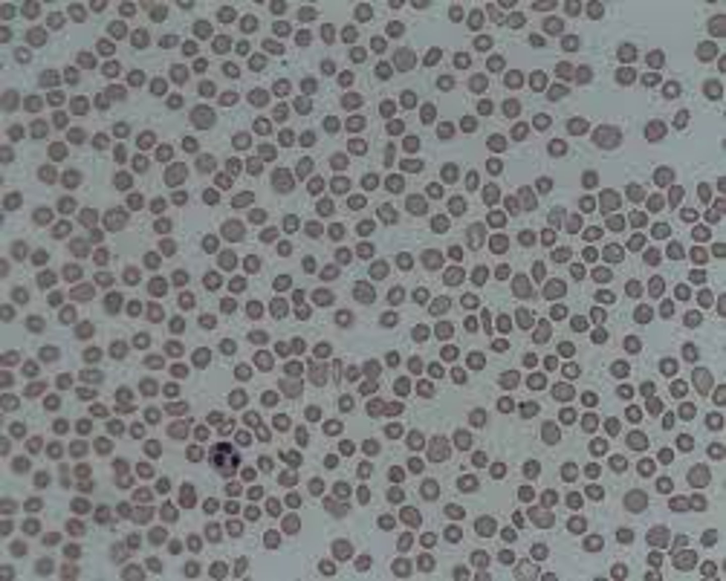 <p>- low platelet count</p><p>- platelets tend to clump and be counted as low numbers or mislabeled in the ProCyte</p>