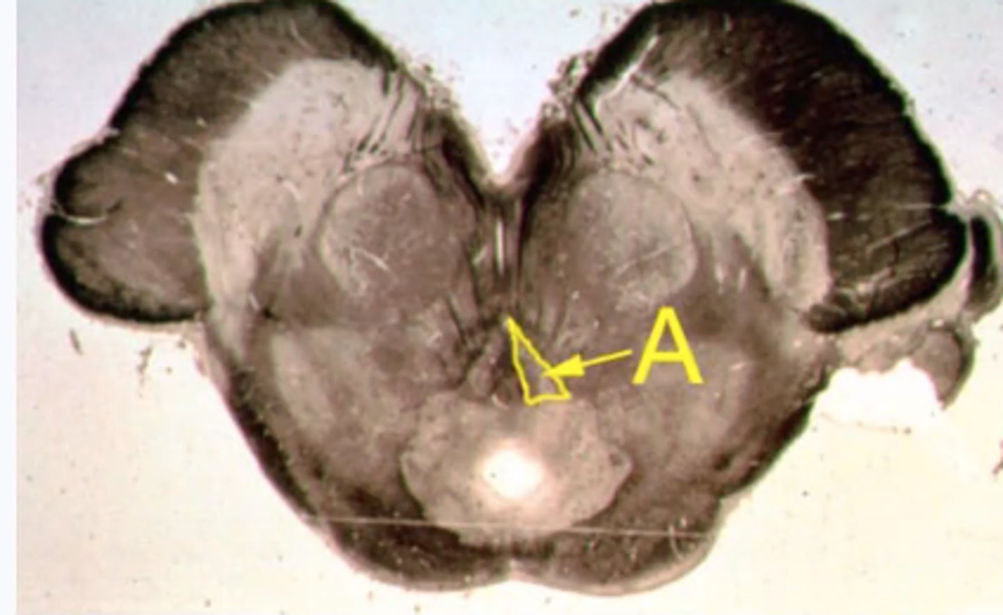 <p>Identify the structures indicated by the outline and letter "A"</p>