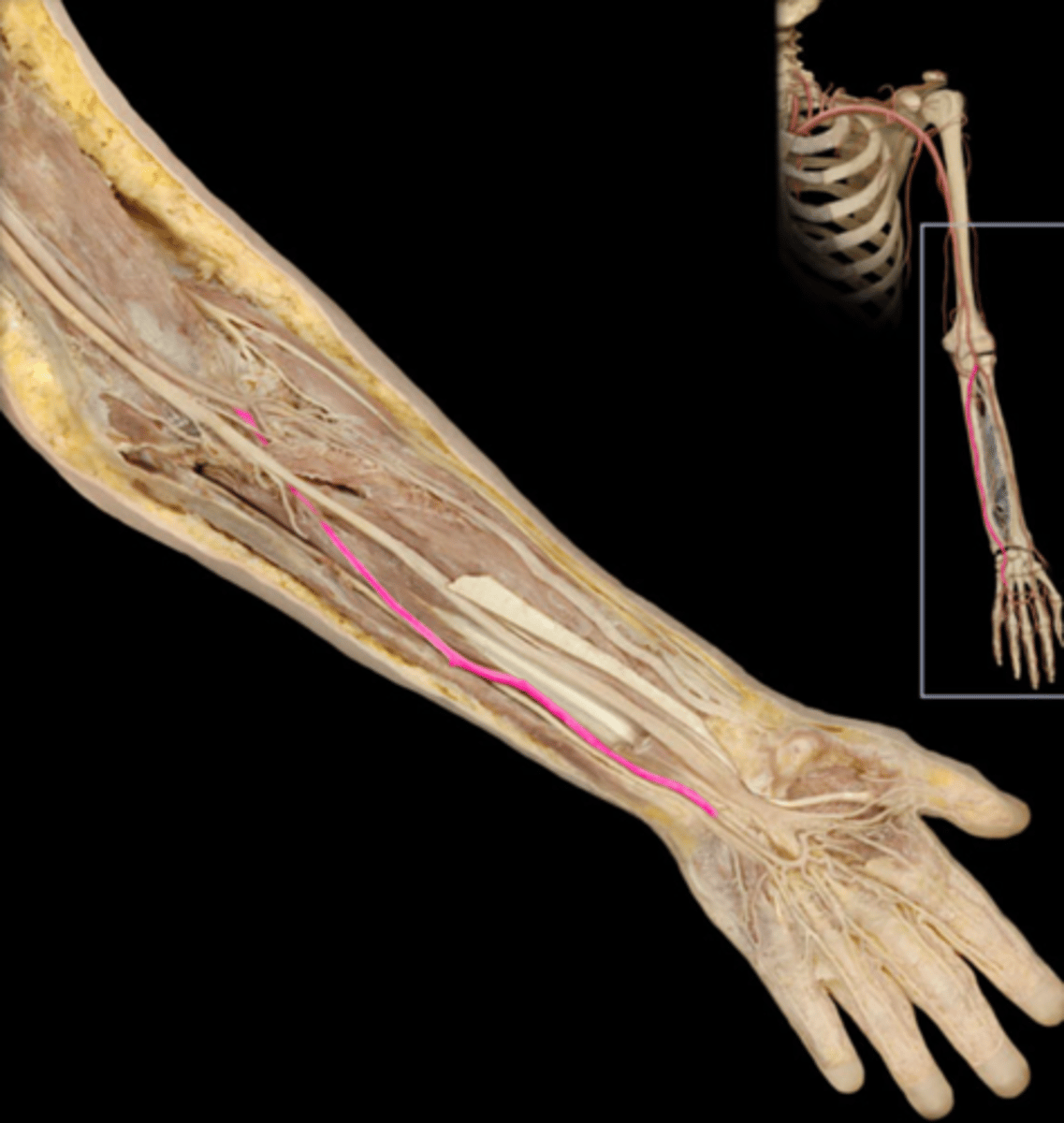 knowt flashcard image